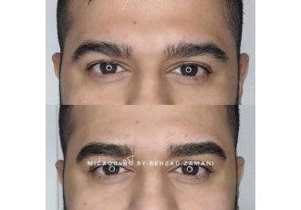 میکروبلیدینگ ابرو آقایان تهران اولین مرکز تخصصی میکروبلیدینگ آقایان