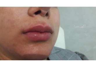 بهترین مرکز لیزر موهای زائد در تهران که با دستگاه های مطب پوست مو