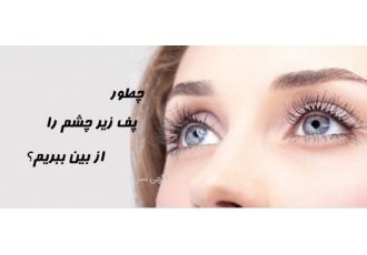 پرداشتن پف چشم در نیم ساعت! زیبا جوی عزیز شما می توانید در عرض نیم ساعت