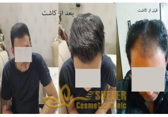 کلینیک تخصصی کاشت مو پوست و زیبایی کلینیک تخصصی کاشت مو وزیبایی شلر