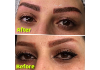 اسکالپ سر مرکز زیبایی اسپرت بیوتی سنتر یکی از بهترین مراکز برای انجام