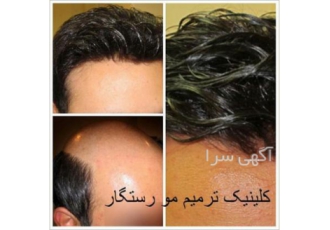 مرکز تخصصی ترمیم مو در اصفهان مرکز تخصصی ترمیم مو رستگار پیوندبیش