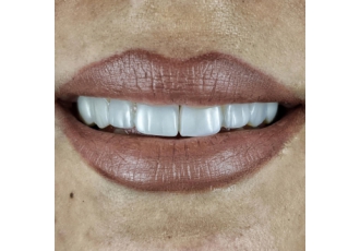 مطب دندانپزشکی دکتر بیاتی و احمدی 🦷 | خدمات تخصصی دندان و زیبایی