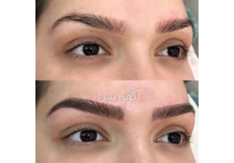 میکروبلیدینگ ونوس | ۵۰% تخفیف ویژه | ابروهای طبیعی و زیبا ✨ آیا