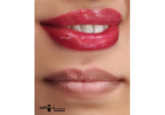 آرایش دائم تخصصی: فیبروز میکروبلیدینگ و خدمات کامل 💫 🌟زیبایی دائمی