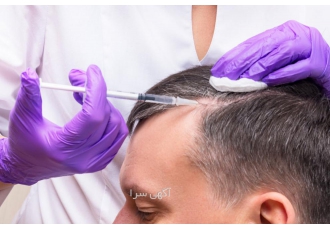 پی آرپی برای ریزش مو اگرچه ریزش مو اغلب با افزایش سن همراه است اما می