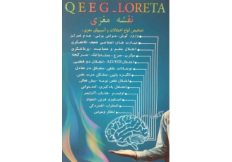 تست نقشه مغزی QEEG: تشخیص دقیق اختلالات مغزی در مرکز مشاوره دکتر فهیمه رضایی 🧠