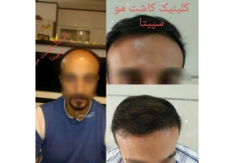 کلینیک زیبایی پوست و مو سپیتا