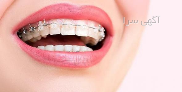 تقویت ابرو سریتا دیجی کالا