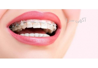 ارتودنسی اقساطی کلینیک دکتر سریتا کلینیک دکتر سریتا یکی از بهترین