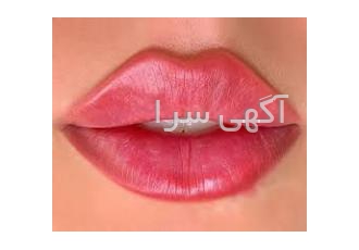 تزریق ژل و بوتاکس خدمات مطب پوست و مو دکتر راد تزریق ژل فیلر از 600
