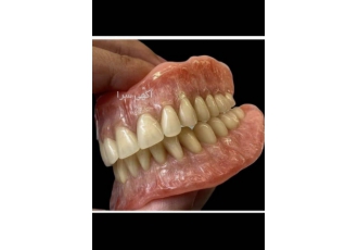 دندانسازی تجربی عسگری انجام امور خدمات دندانسازی به همشهریان عزیز پروتز