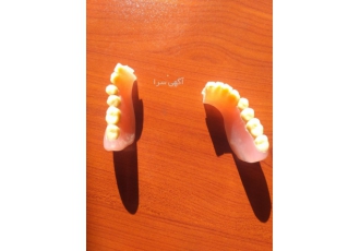 لابراتوار دندانسازی شمال غرب 🦷 | ساخت پروتز ثابت و متحرک با کیفیت و تضمین