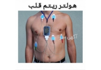 اجاره هولتر ریتم قلب در مشهد اجاره هولتر ریتم قلب با کیفیت بالا قیمت