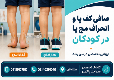 صافی کف پا و انحراف مچ پا کلینیک کهن در تهران 👣 صافی کف پا و انحراف مچ